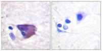 Kv2.1 (phospho Ser567) Polyclonal Antibody