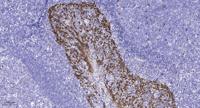 Kv4.2 (phospho Ser616) Polyclonal Antibody