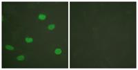 Lamin A/C (phospho Ser392) Polyclonal Antibody