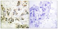 Lamin A/C (phospho Ser392) Polyclonal Antibody