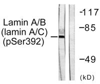 Lamin A/C (phospho Ser392) Polyclonal Antibody
