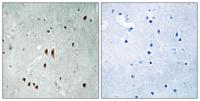 CNOT2 (phospho Ser101) Polyclonal Antibody