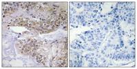 Cofilin (phospho Ser3) Polyclonal Antibody