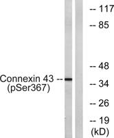 Connexin 43 (phospho Ser368) Polyclonal Antibody