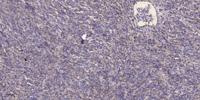 Cortactin (phospho Tyr421) Polyclonal Antibody