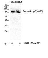 Cortactin (phospho Tyr466) Polyclonal Antibody