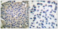 Cortactin (phospho Tyr466) Polyclonal Antibody