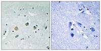 Cot (phospho Ser400) Polyclonal Antibody
