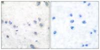 Cot (phospho Thr290) Polyclonal Antibody