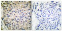 CPI-17 (phospho Thr38) Polyclonal Antibody
