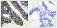cPLA2 (phospho Ser505) Polyclonal Antibody
