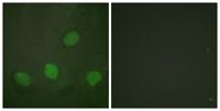 CREB-1 (phospho Ser142) Polyclonal Antibody