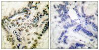CREB-1 (phospho Ser142) Polyclonal Antibody