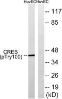 CREB-1 (phospho Thr100) Polyclonal Antibody