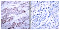 CREB-2 (phospho Ser245) Polyclonal Antibody