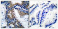 Crk-L (phospho Tyr207) Polyclonal Antibody