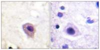 CRMP-2 (phospho Thr514) Polyclonal Antibody