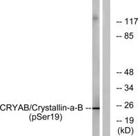 Crystallin-αB (phospho Ser19) Polyclonal Antibody