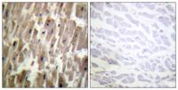 Crystallin-αB (phospho Ser45) Polyclonal Antibody
