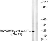 Crystallin-αB (phospho Ser45) Polyclonal Antibody