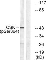 Csk (phospho Ser364) Polyclonal Antibody