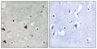 CSN1 (phospho Ser454) Polyclonal Antibody