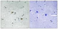 c-Src (phospho Ser75) Polyclonal Antibody