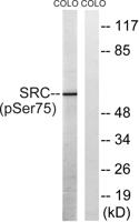 c-Src (phospho Ser75) Polyclonal Antibody