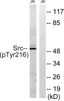 c-Src (phospho Tyr216) Polyclonal Antibody
