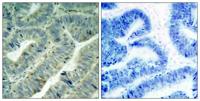 c-Src (phospho Tyr419) Polyclonal Antibody