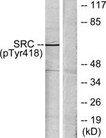 c-Src (phospho Tyr419) Polyclonal Antibody