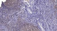 c-Src (phospho Tyr419) Polyclonal Antibody