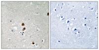 CtBP1 (phospho Ser422) Polyclonal Antibody