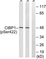 CtBP1 (phospho Ser422) Polyclonal Antibody