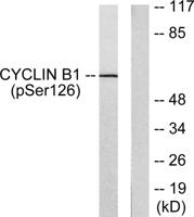 Cyclin B1 (phospho Ser126) Polyclonal Antibody