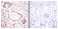 Cyclin B1 (phospho Ser147) Polyclonal Antibody