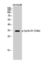 Cyclin D1 (phospho Thr286) Polyclonal Antibody