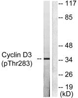 Cyclin D3 (phospho Thr283) Polyclonal Antibody