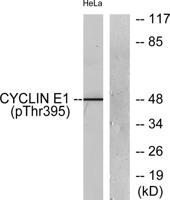 Cyclin E1 (phospho Thr395) Polyclonal Antibody