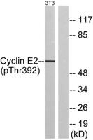 Cyclin E2 (phospho Thr392) Polyclonal Antibody