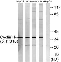 Cyclin H (phospho Thr315) Polyclonal Antibody