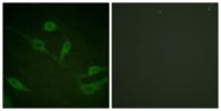 Cytokeratin 18 (phospho Ser33) Polyclonal Antibody