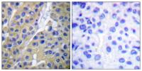 Cytokeratin 18 (phospho Ser33) Polyclonal Antibody