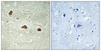 Cytokeratin 18 (phospho Ser52) Polyclonal Antibody