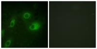 Cytokeratin 18 (phospho Ser52) Polyclonal Antibody