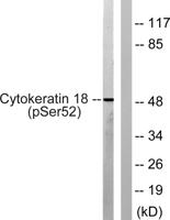 Cytokeratin 18 (phospho Ser52) Polyclonal Antibody