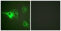 Cytokeratin 8 (phospho Ser432) Polyclonal Antibody