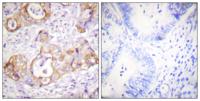 Cytokeratin 8 (phospho Ser432) Polyclonal Antibody