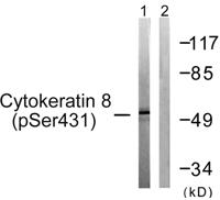 Cytokeratin 8 (phospho Ser432) Polyclonal Antibody
