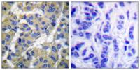 Cytokeratin 8 (phospho Ser73) Polyclonal Antibody
